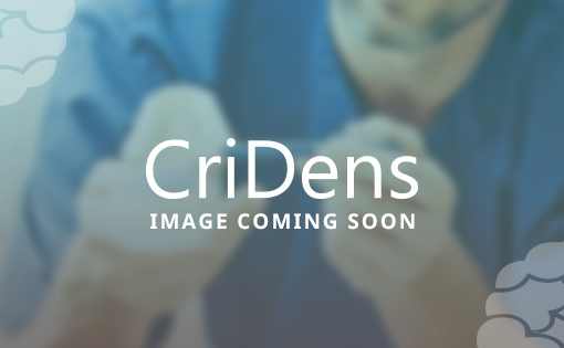 CriDens image coming soon