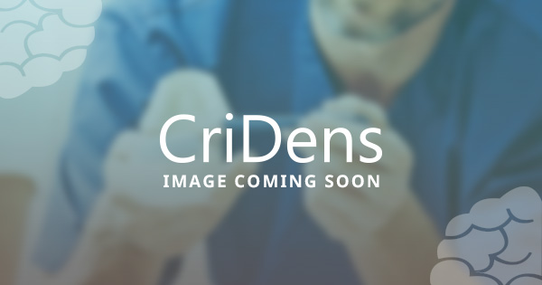 CriDens image coming soon